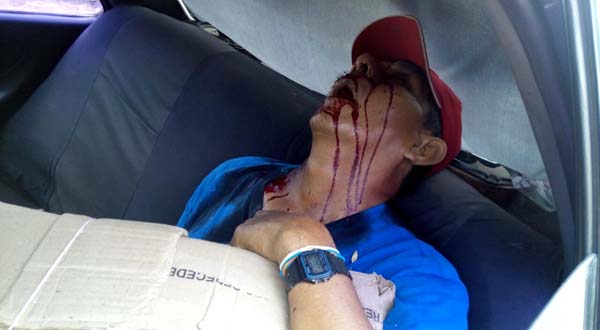 asesinado-taxi1