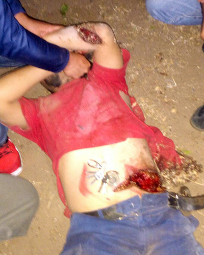 arrollados-motocicleta1